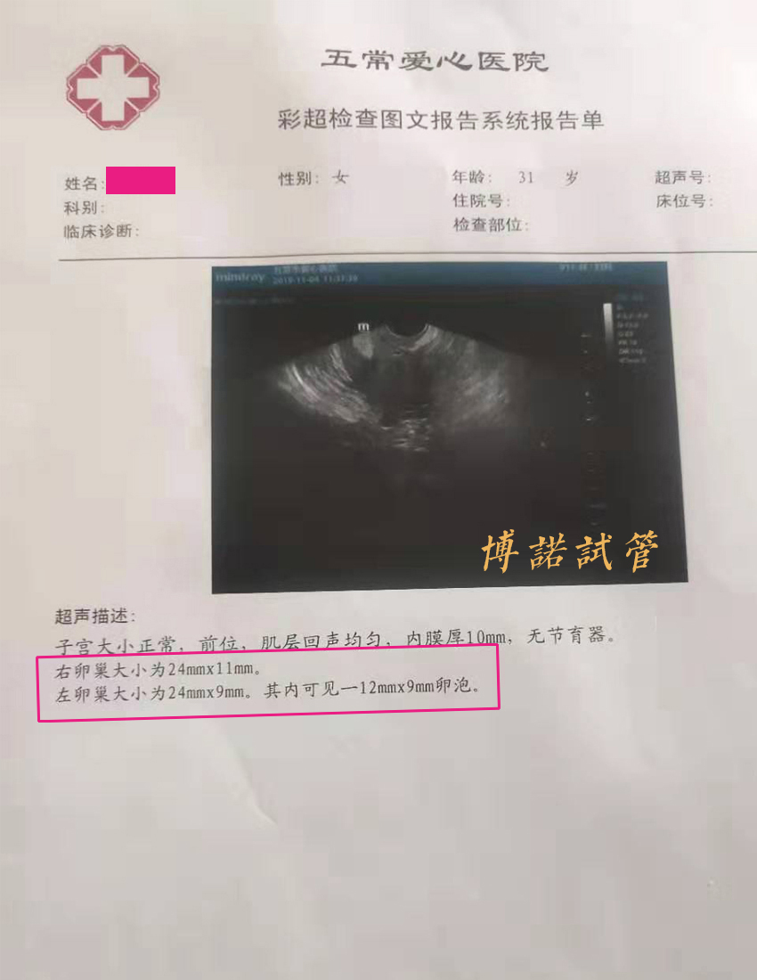 广州借卵费用.jpg