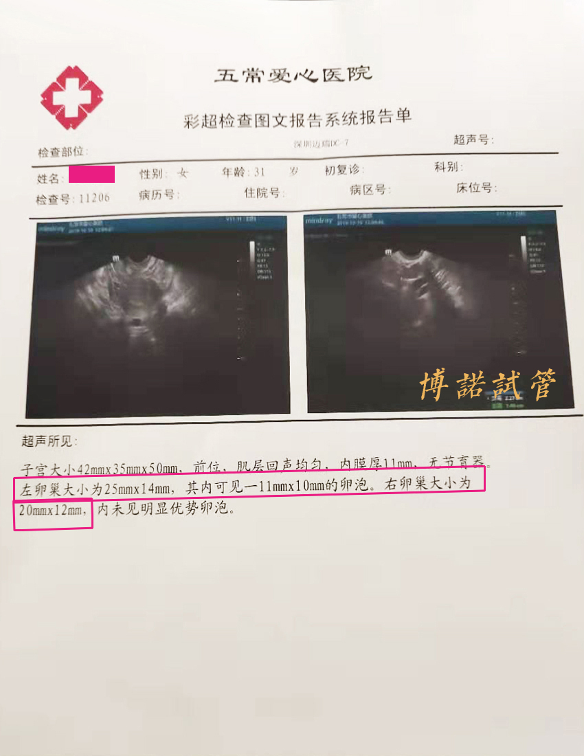 广州借卵生子.jpg