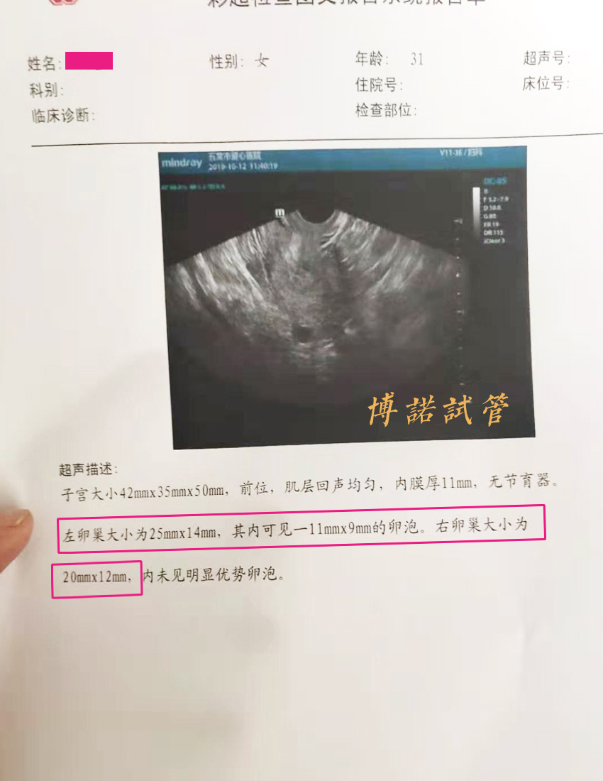 广州借卵试管医院.jpg