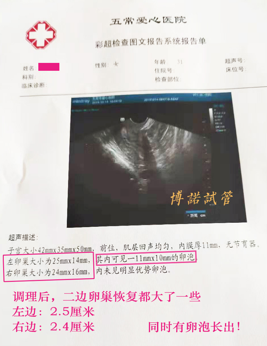 广州借卵怀孕经历.jpg