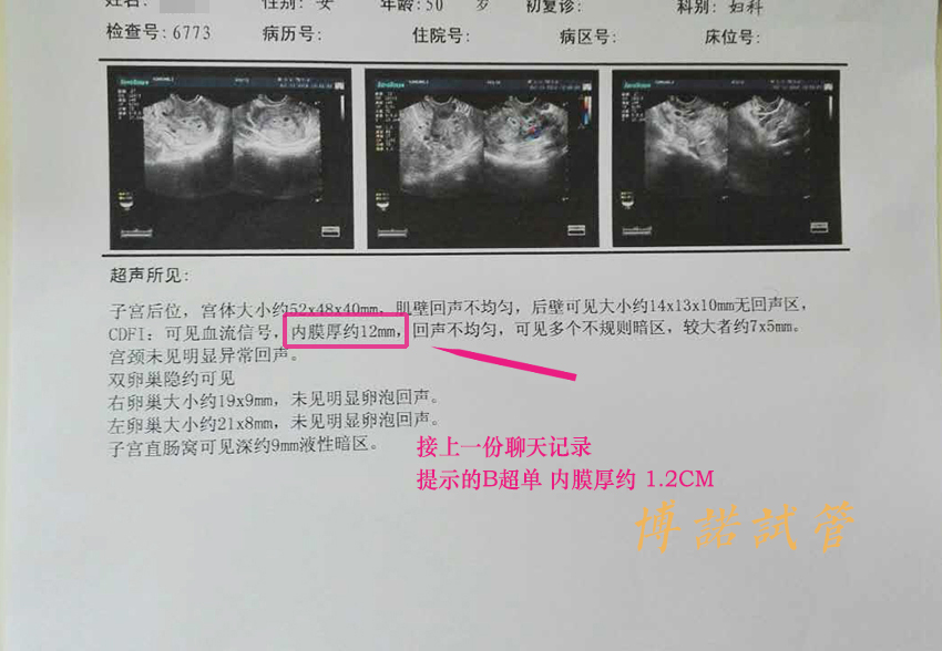 广州借卵助孕流程.jpg