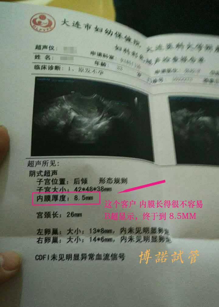 广州借卵试管婴儿.jpg