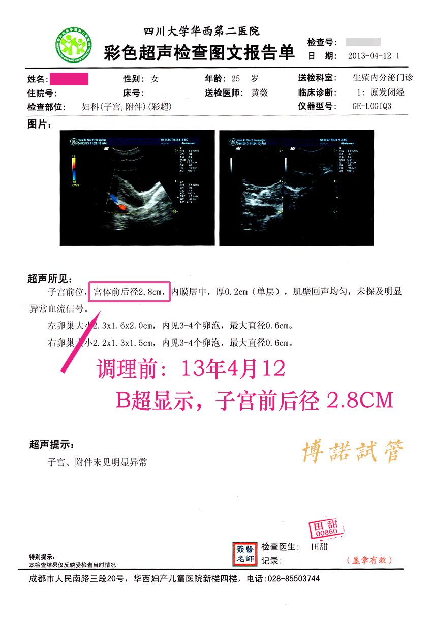 广州借卵试管.jpg